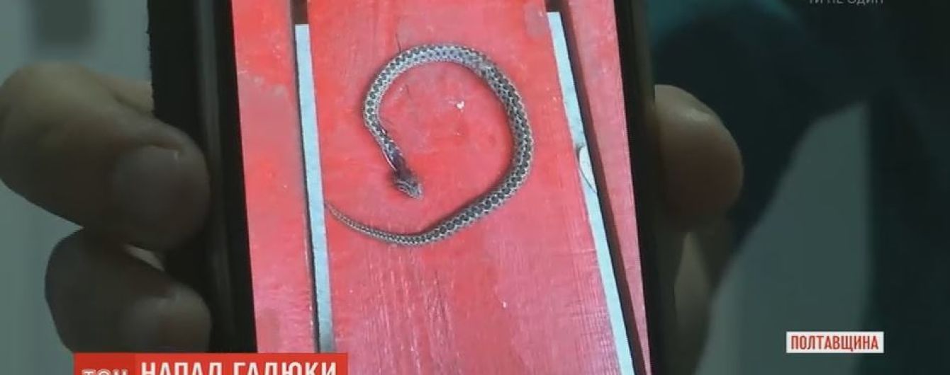 После укуса гадюки в реанимации оказалась 7-летняя девочка из Кременчуга