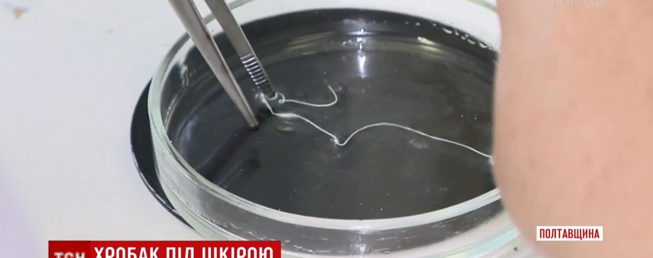 Червь в глазу: украинцам рассказали, как избежать отвратительной болезни под названием дирофиляриоз
