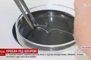 Хробак в оці: українцям розповіли, як уникнути огидної хвороби під назвою дирофіляріоз