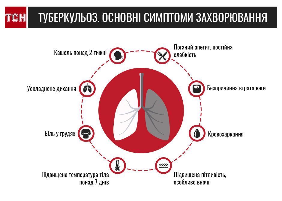 туберкульоз інфографіка