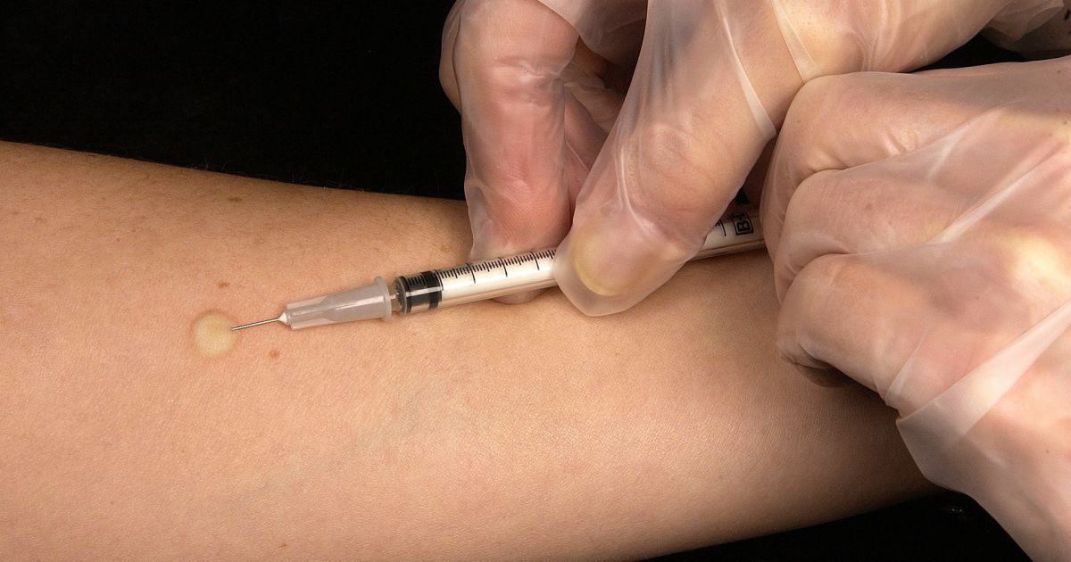 У Кременчуці заборонять відвідувати школи та садки нещепленим від кору дітям