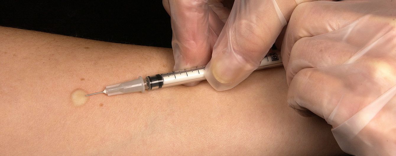 В Кременчуге запретят посещать школы и сады непривитым от кори детям