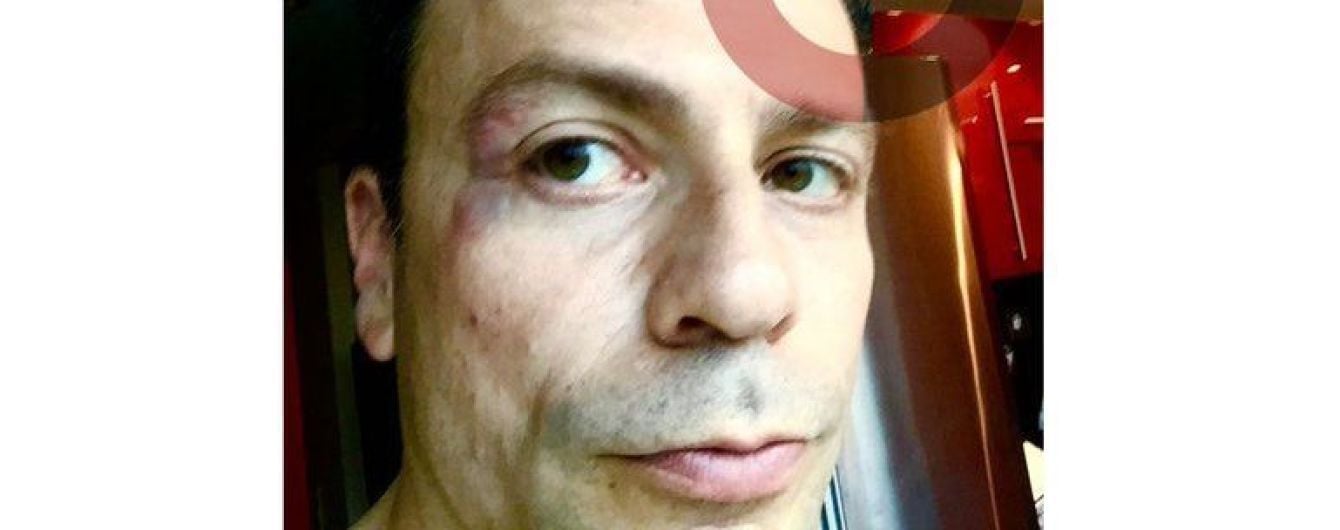 Экс-футболист сборной России ударил журналиста в лицо