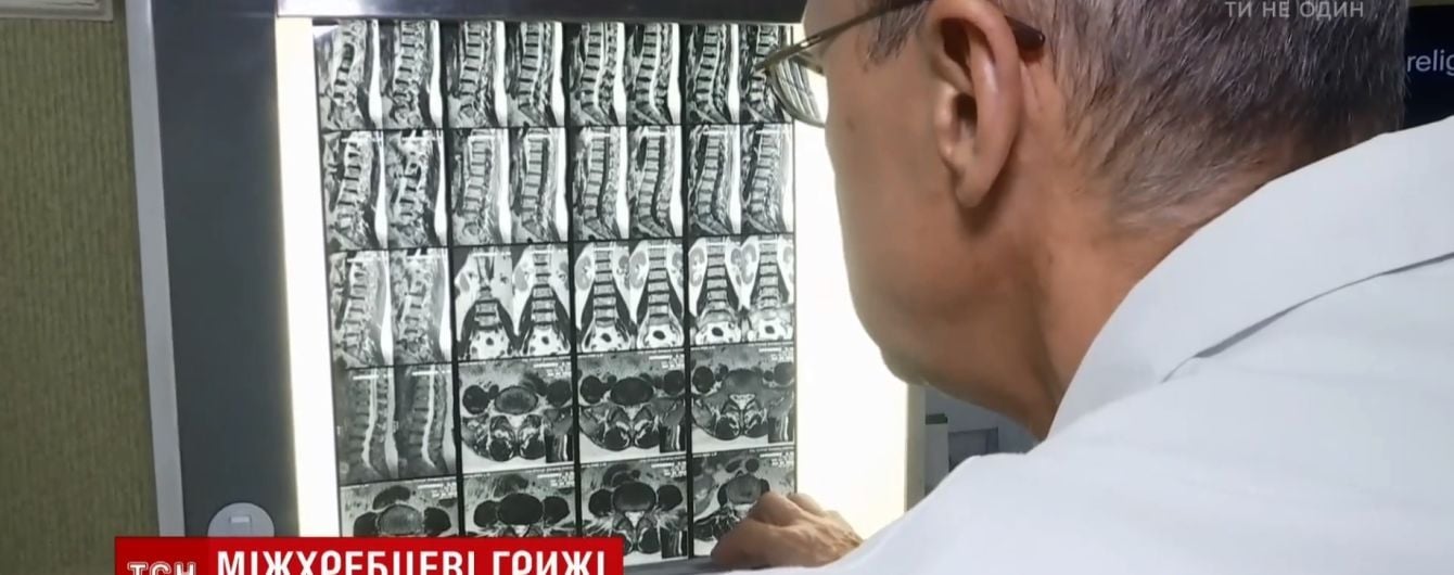 Йога і розумний лікар: науковці розповіли, як позбутися гриж хребта без операцій