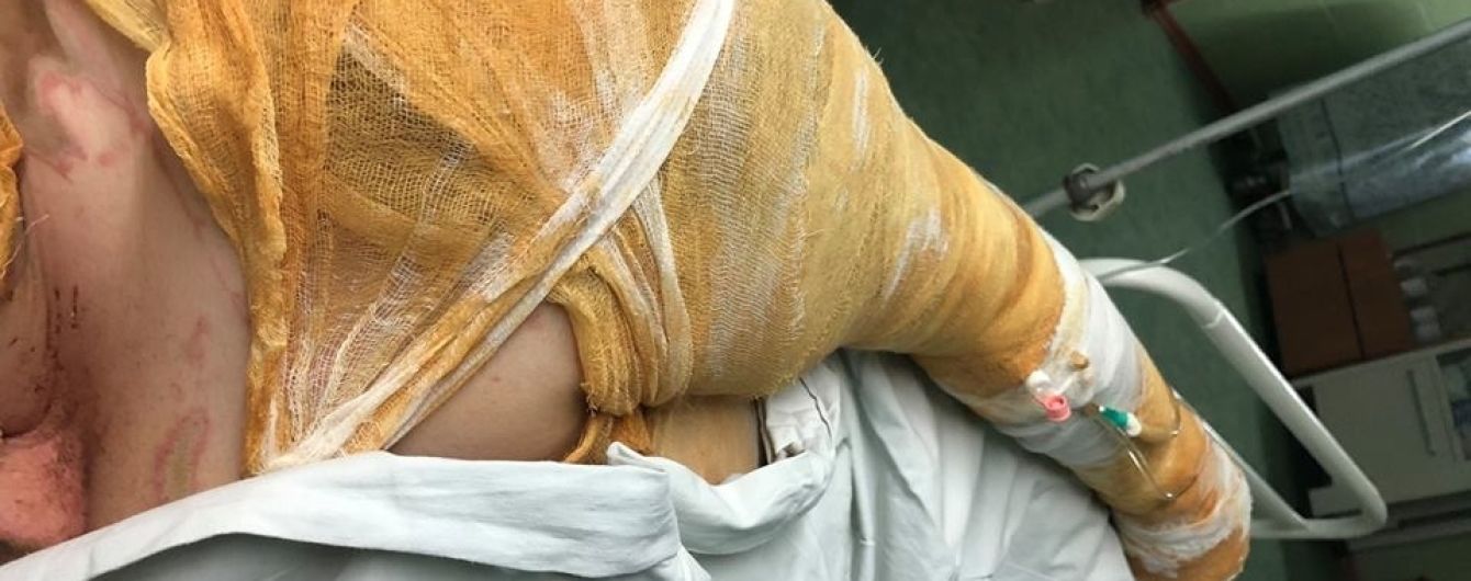 Активистку Гандзюк, которую облили ядом в Херсоне, перевезут в Киев - СМИ