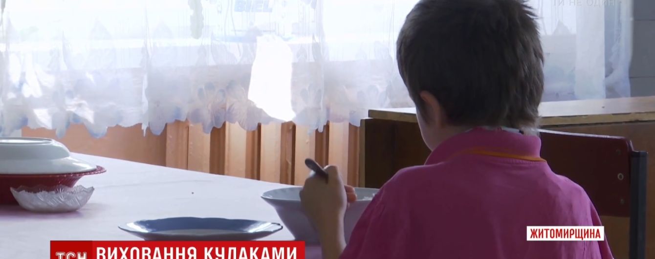 Перелом плеча і гематоми: на Житомирщині батько ледве не до інвалідності побив 8-річну доньку