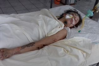 Стали відомі подробиці ДТП на Київщині, після котрої без тями лежить у реанімації невпізнана дівчина