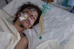 На Київщині у лікарні без тями лежить постраждала у ДТП. Медики просять допомогти її опізнати