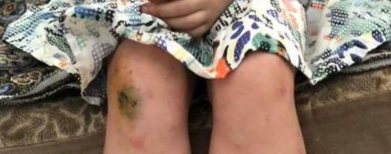 В Одесі в притулку вихователі побили дітей – поліція перевіряє інформацію