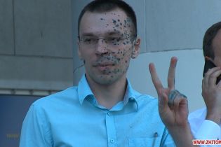 В Житомире возле суда облили зеленкой пророссийского блогера