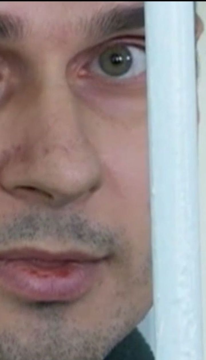 Сестра Сенцова сообщила об ухудшении состояния политзаключенного