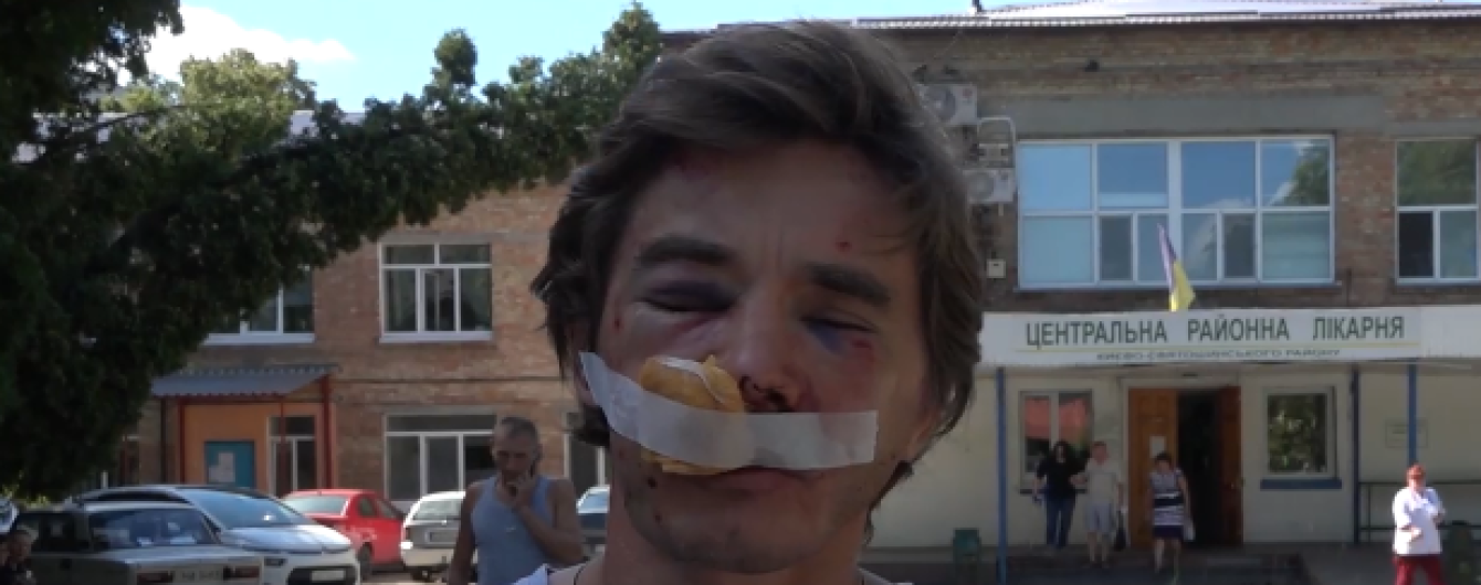 У Вишневому побили активіста, який боровся проти забудови зеленої зони