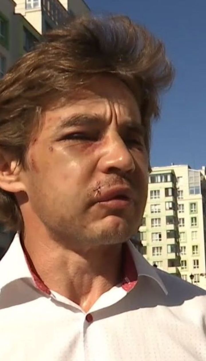 В Вишневом жестоко избили активиста, который борется с незаконными застройками