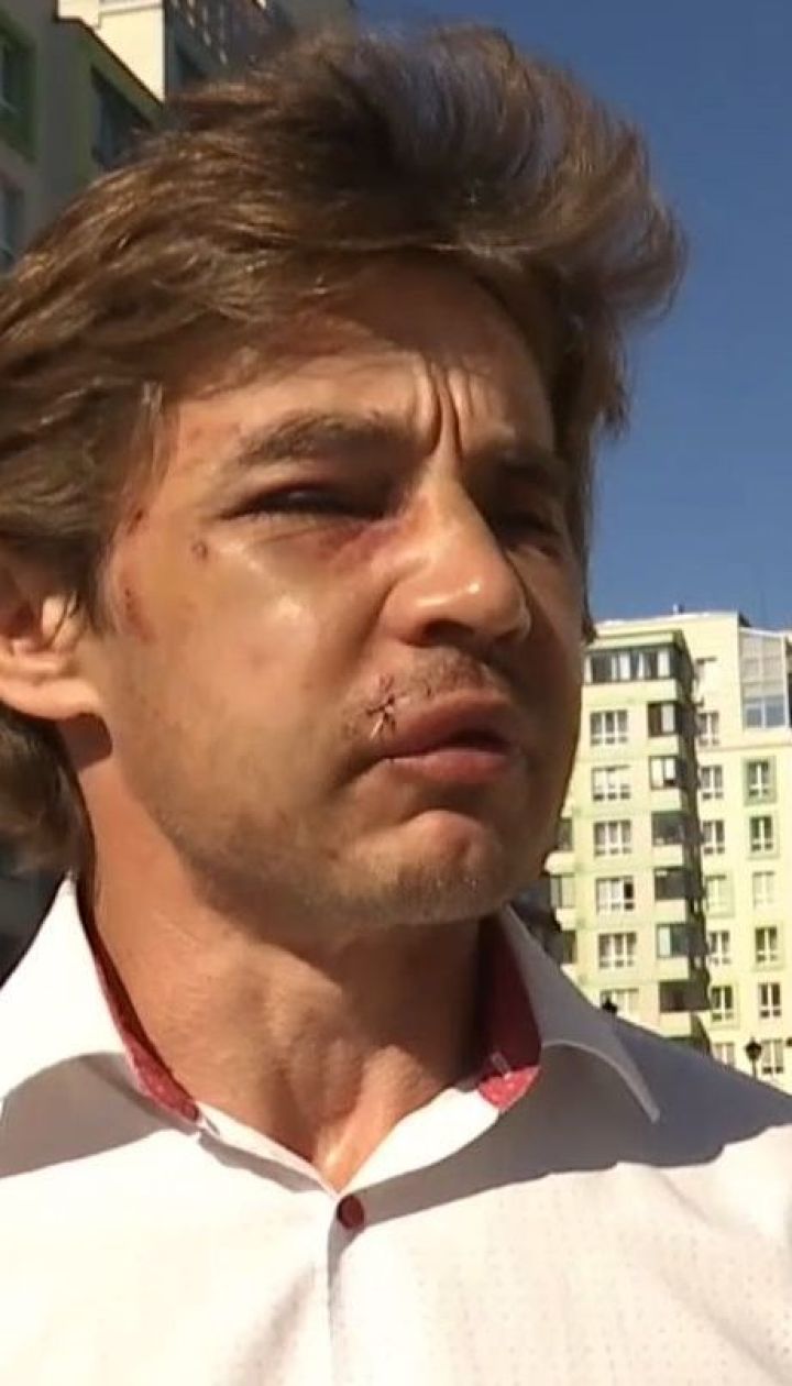 У Вишневому жорстоко побили активіста, який бореться з незаконними забудовами