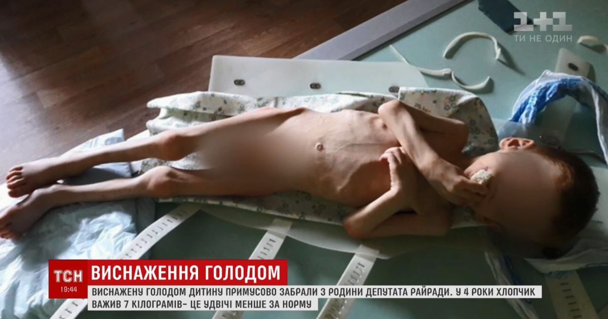 Як із концтабору: на Кіровоградщині депутат ледве не заморив голодом власне дитя