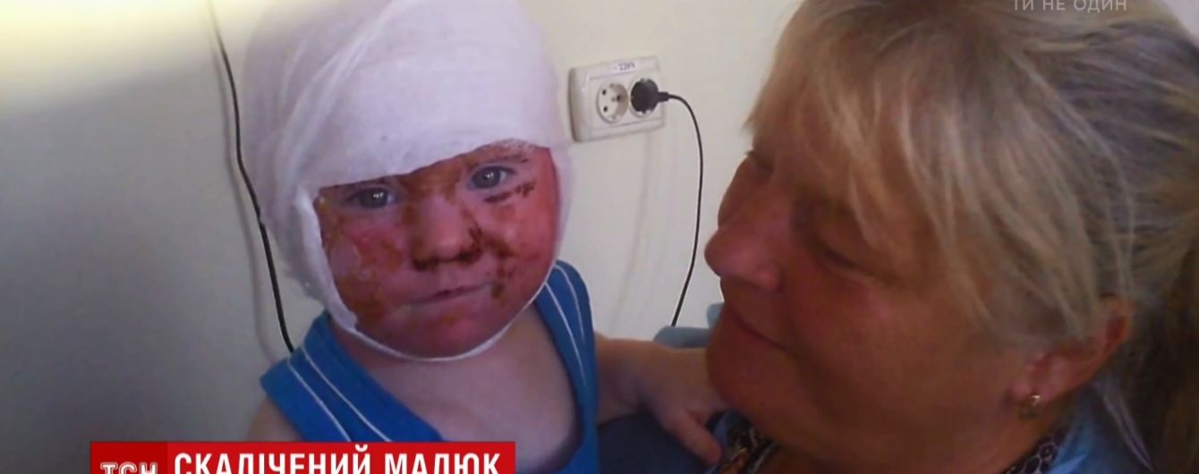 На Кіровоградщині у будинку дитини вихователька вилила окріп на півторарічного малюка