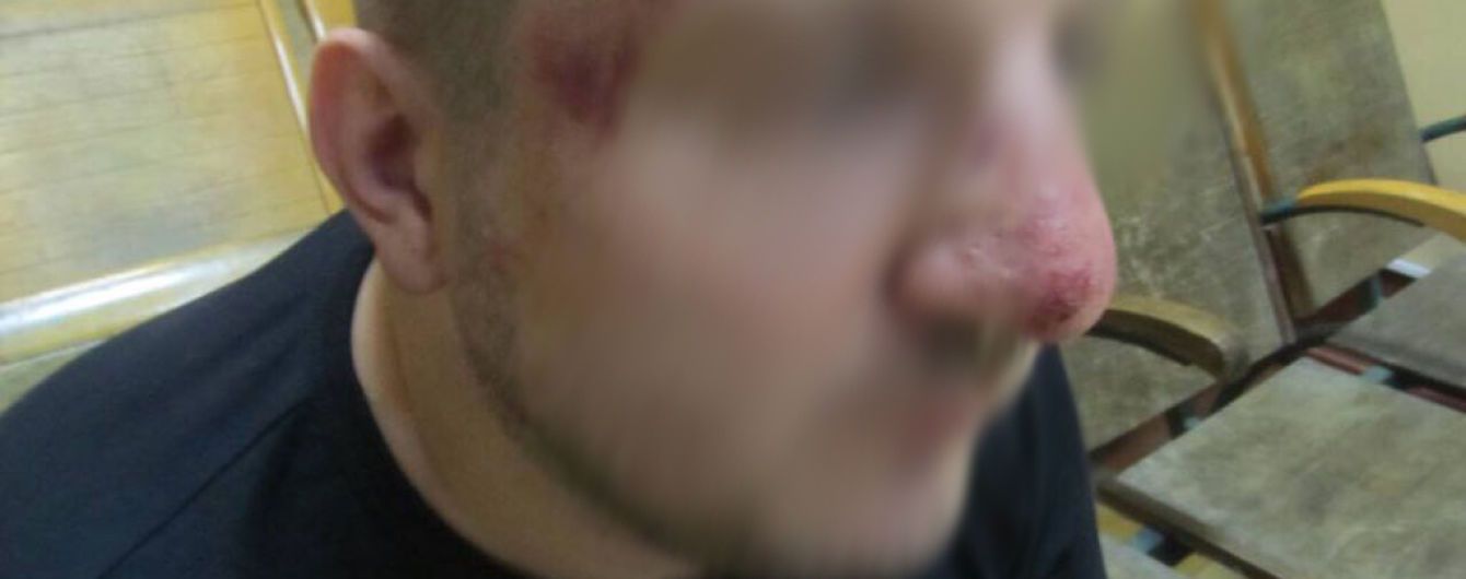 Российские пограничники сняли украинца с поезда и избили его - ГПСУ