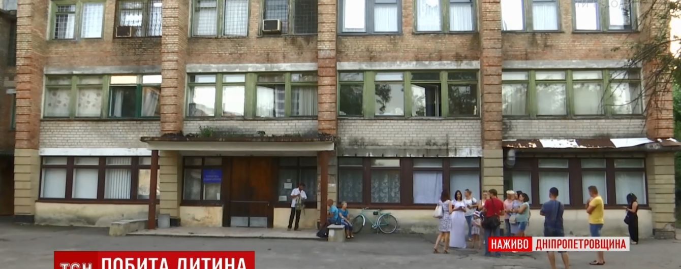 У Жовтих Водах до реанімації потрапила 4-річна дівчинка зі слідами звірячого побиття