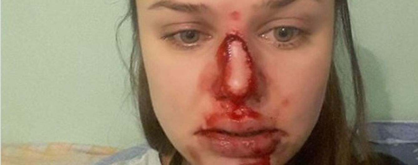 Київський психолог публічно заявила про домашнє насильство з боку чоловіка. Луценко чекає на заяву