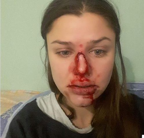 Лілія Шевцова домашнє насилля