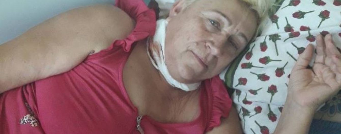 Рак шкіри уразив Валентину і їй потрібна допомога