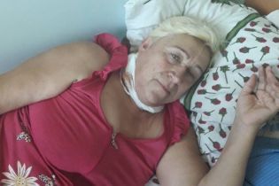Рак шкіри уразив Валентину і їй потрібна допомога