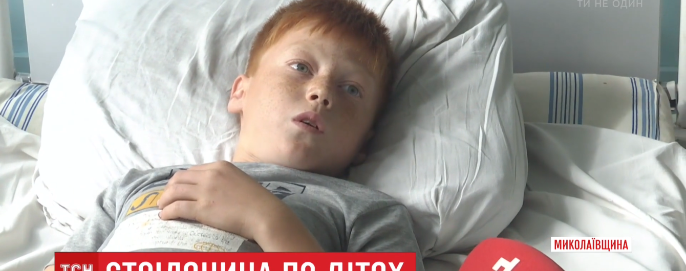 Пьяному пенсионеру, который подстрелил из дробовика троих детей, оторвало палец на руке. Подробности инцидента