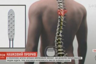 Науковий прорив: У США новітній імплант дозволяє паралізованим людям ходити