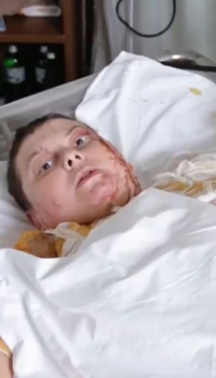 Облита кислотою активістка Катерина Гандзюк записала відеозвернення