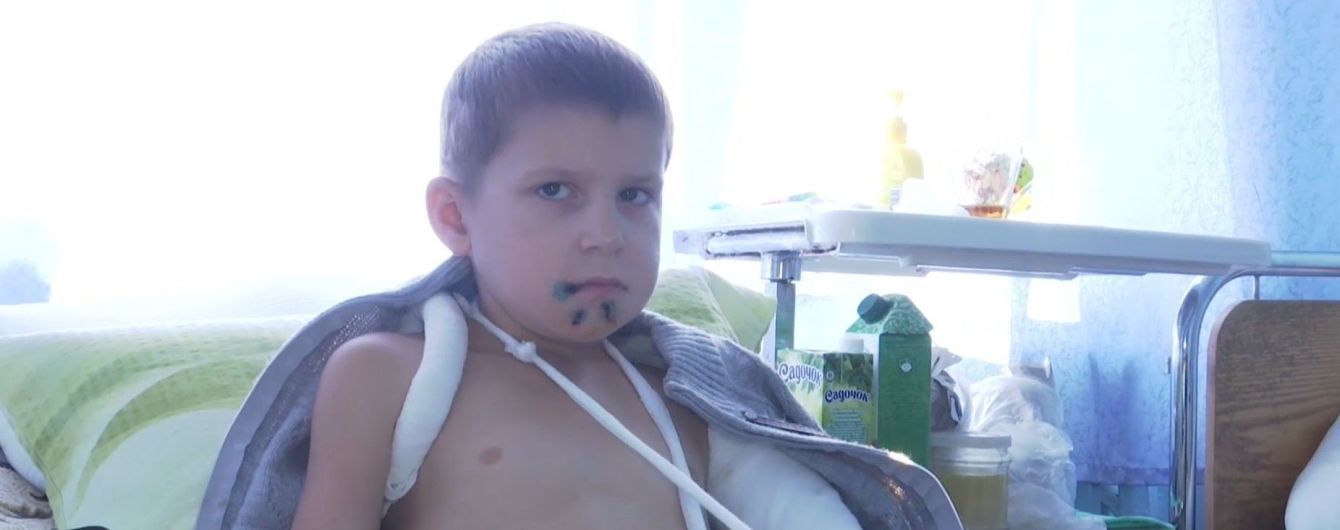 На Житомирщине после удара шлагбаумом ребенок в тяжелом состоянии попала в больницу