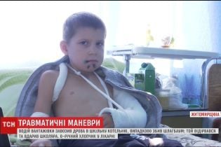 На Житомирщині після удару шлагбаумом дитина у тяжкому стані потрапила до лікарні