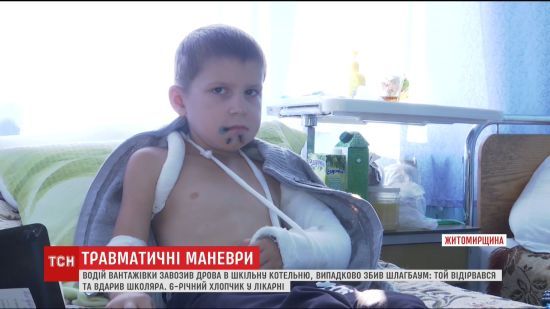 На Житомирщині після удару шлагбаумом дитина у тяжкому стані потрапила до лікарні