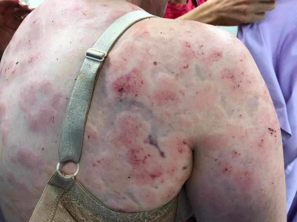 Жінка закрила собою дитину під час граду_1