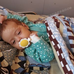 2-місячна Міланка потребує негайної трансплантацію печінки
