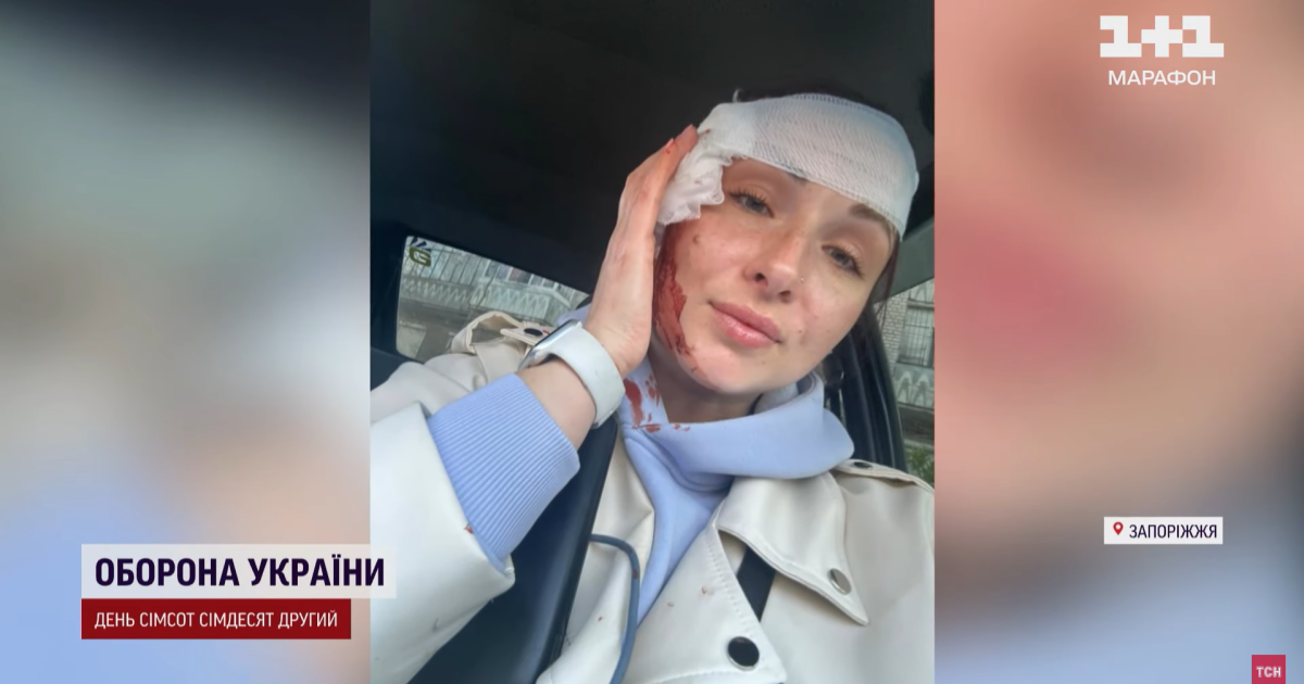 Журналістка ТСН Кіра Овес зазнала поранення під час знімань у Запоріжжі