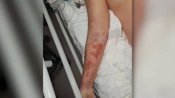 Рука Катерини Тишкевич / © скриншот з відео