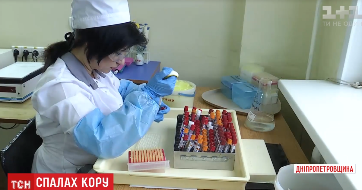 Спалах кору: у КМДА пояснили, що робити батькам не прищеплених дітей