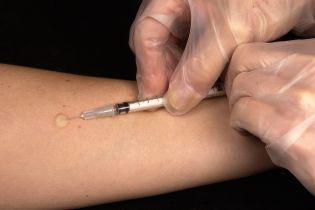 Врачи констатируют, что вспышка кори в Киеве стала крупнейшей за годы независимости Украины