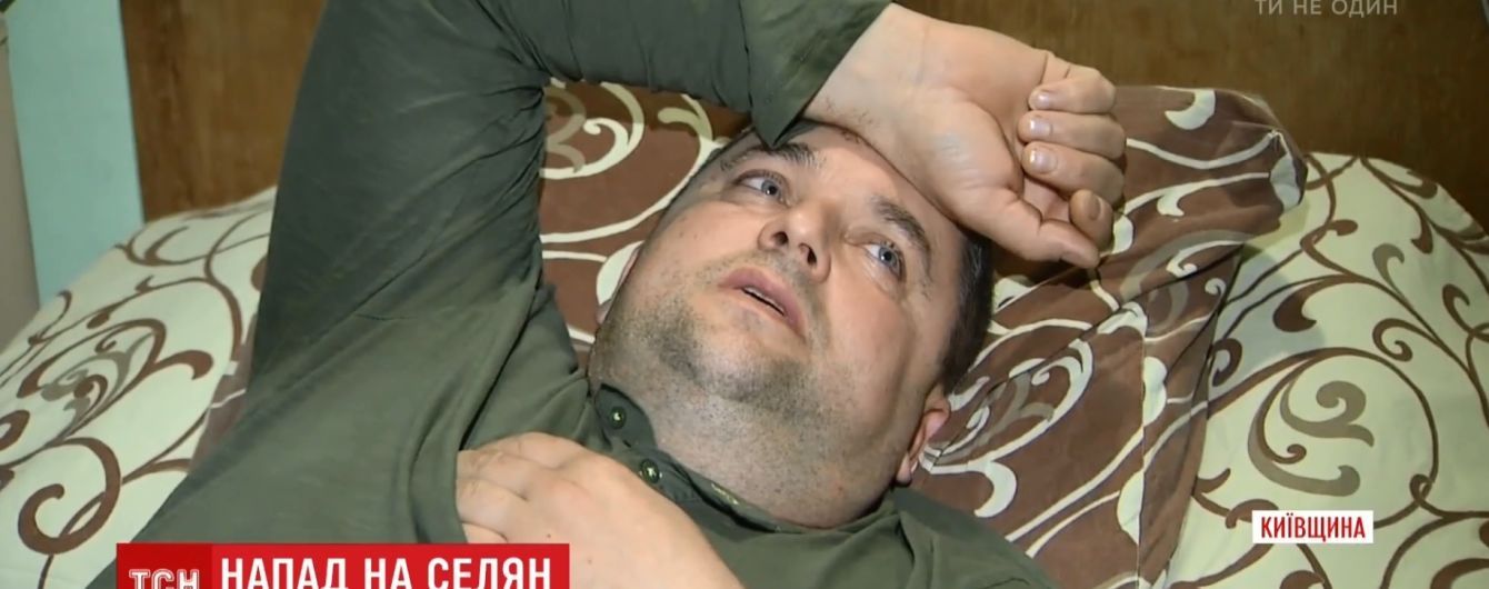 П’яний нардеп-радикал побив сільського голову на Київщині та погрожував убивством – постраждалий
