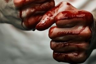 Жорстокі побої та "традиційні цінності": жінка російського багатія втекла від чоловіка-деспота в Україну