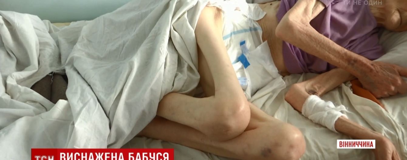Возраст 87, вес 30: в Винницкой области сын едва не заморил до смерти родную мать голодом