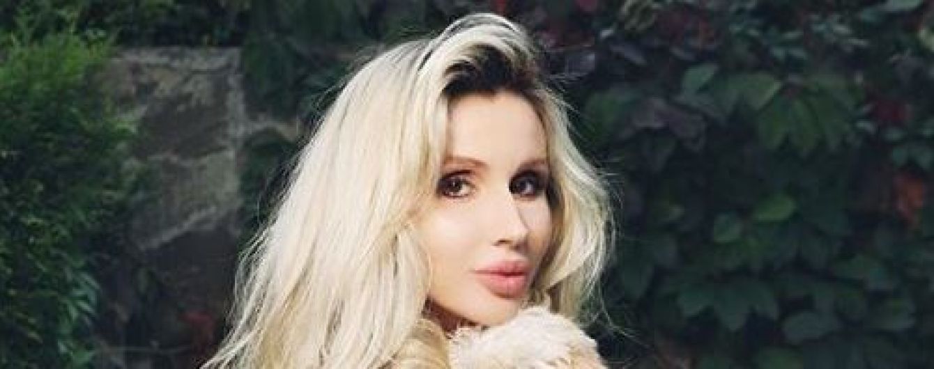Світлана Лобода вперше публічно розповіла, як ледь не втратила нирку