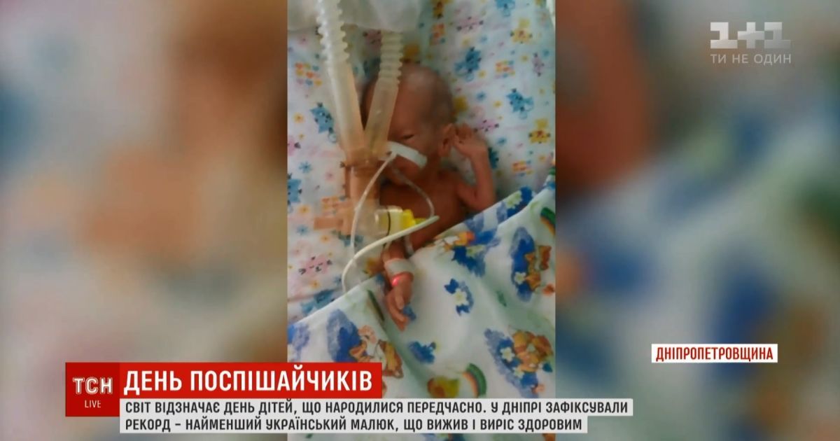 Самый крохотный малыш в Украине родился в Днепре