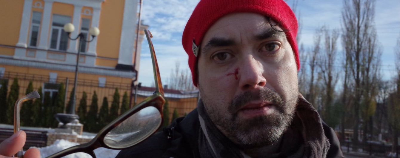 На "трансмарше" в Киеве радикалы избили иностранного журналиста