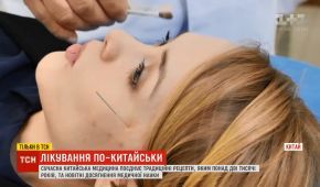 Голки в голову і щурячі екскременти: китайська медицина шокує засобами лікування