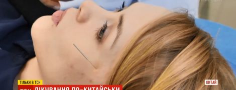 Голки в голову і щурячі екскременти: китайська медицина шокує засобами лікування