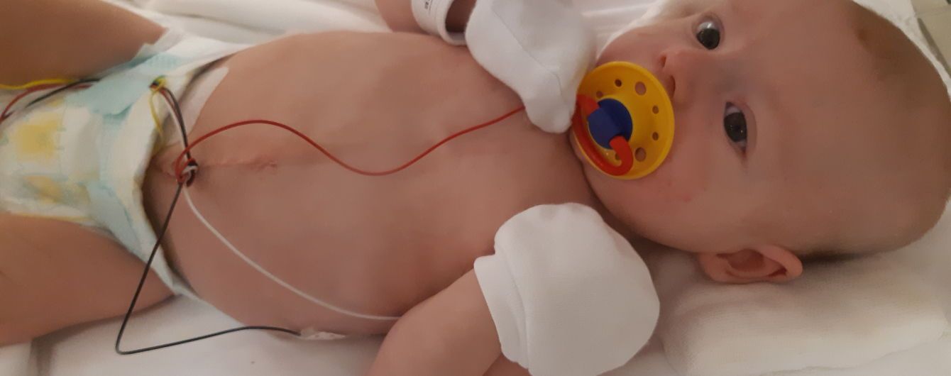 Ваша жертовна допомога може врятувати життя 3-місячного Артемка