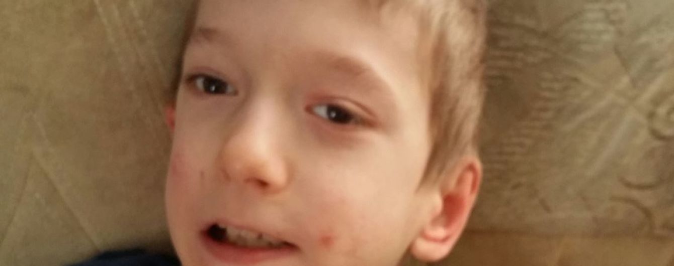 Помощи в преодолении болезни нуждается 11-летний Вася
