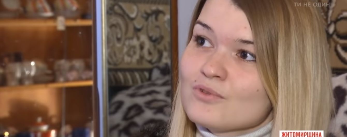 Бомба в голові: в Інституті нейрохірургії успішно видалили аномальний клубок судин з мозку дівчини