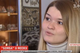 Бомба в голове: в Институте нейрохирургии успешно удалили аномальный клубок сосудов из мозга девушки
